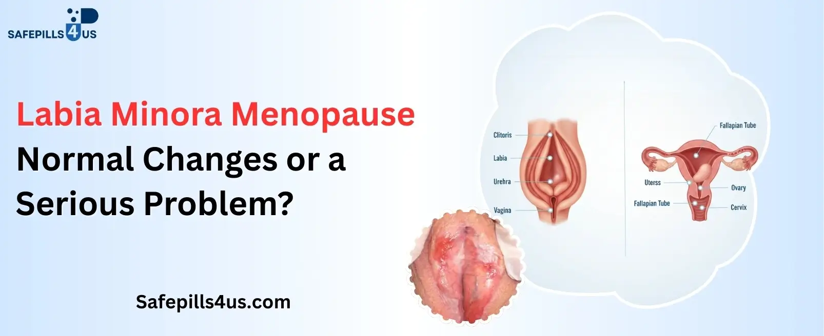 Labia Minora Menopause: Normal Changes or a Serious Problem?