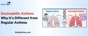 Eosinophilic Asthma